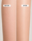 skin-after-before