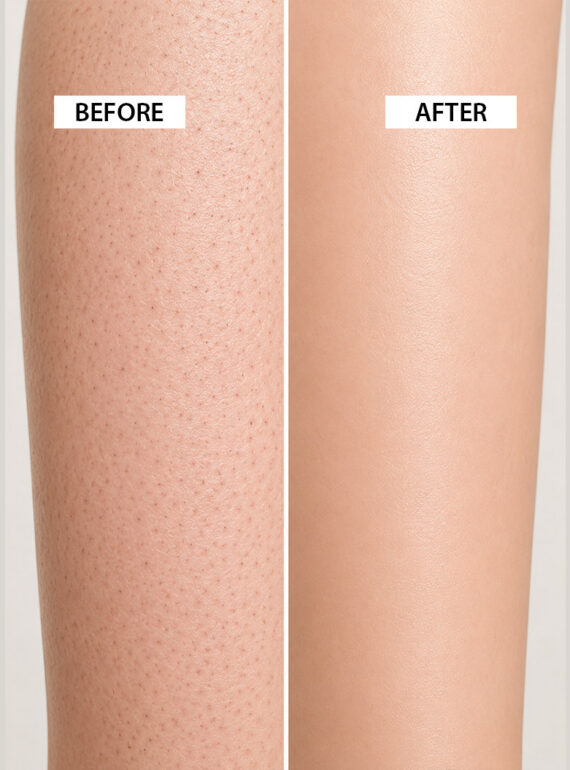 skin-after-before